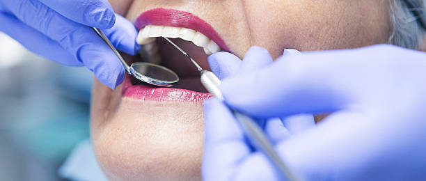 Best Emergency Treatment for Dental Infections or Abscesses in Brainerd, MN